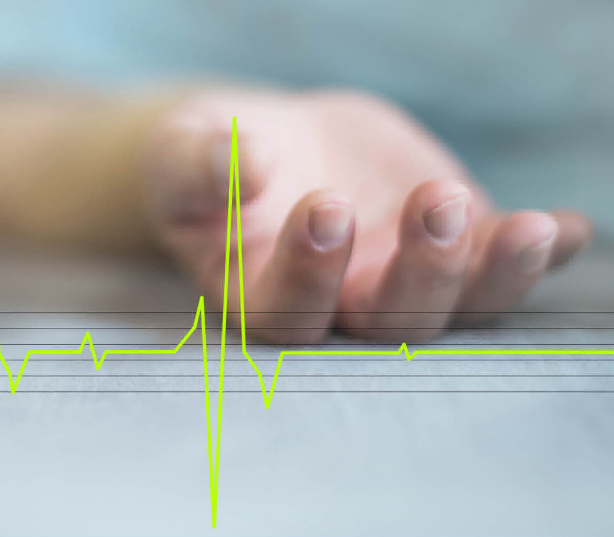 Schnelle Notfallherapie kann Leben bei einem Herzkreislaufstillstand retten